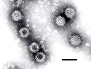 Electron micrograph of rotavirus particles